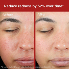 EltaMD UV Skin Recovery, teinte verte: correction visuelle et protection quotidienne du visage.