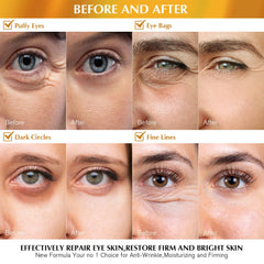 Enaskin Naturals gel-yeux-24k-or contient hyaluronique pour hydratation durable.