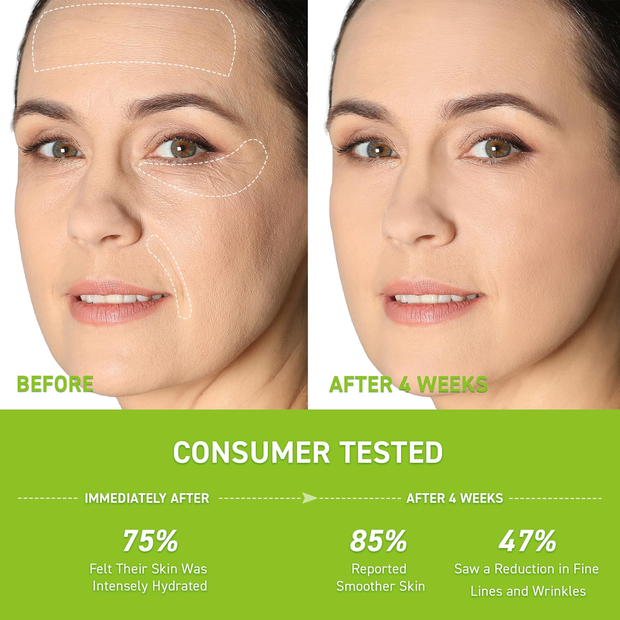 Sérum Retinol Enaskin Naturals Hyaluronique – Hydratation profonde et peau souple.