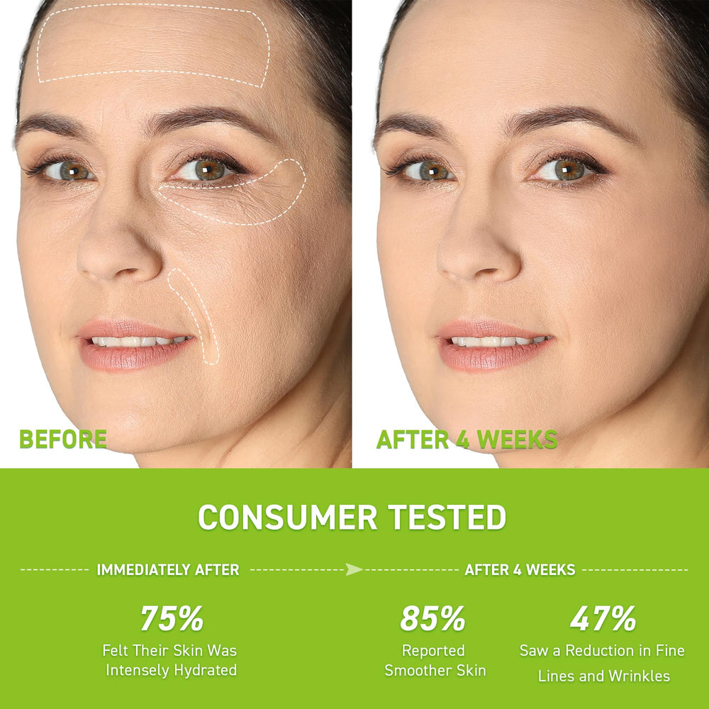 Sérum Retinol Enaskin Naturals Hyaluronique – Hydratation profonde et peau souple.