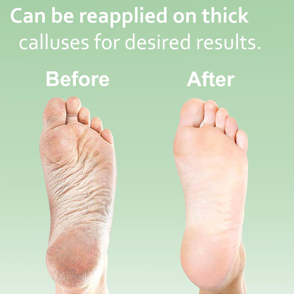 Kit spa EntreFeet pour pieds à domicile, résultats doux et professionnels.