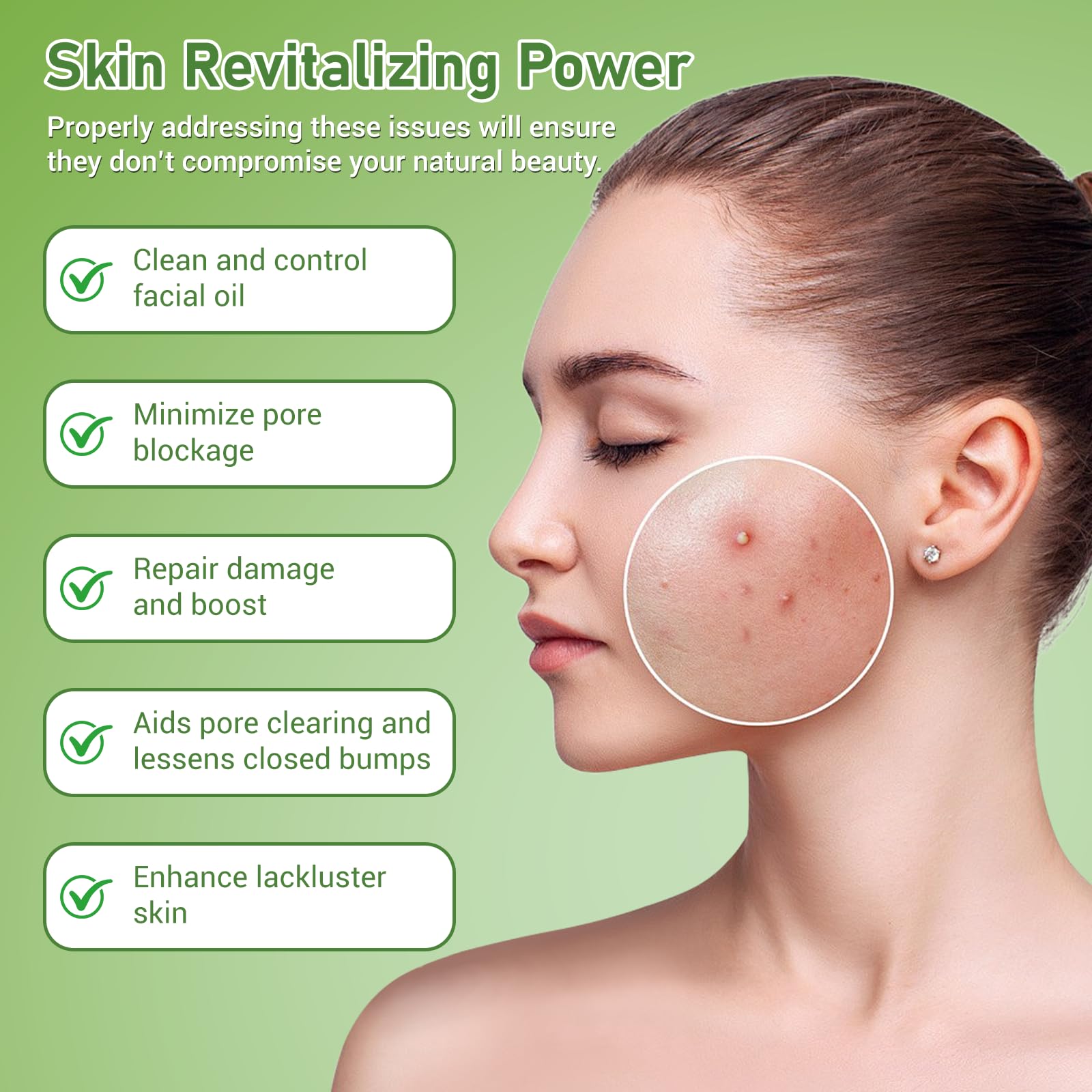 Eofot azelaic acid cream application in hand suggesting daily use