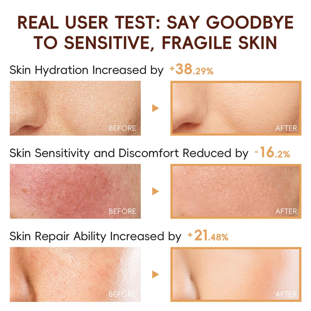 EONFAVE crème contour des yeux pour réduire les tiraillements et les cernes.