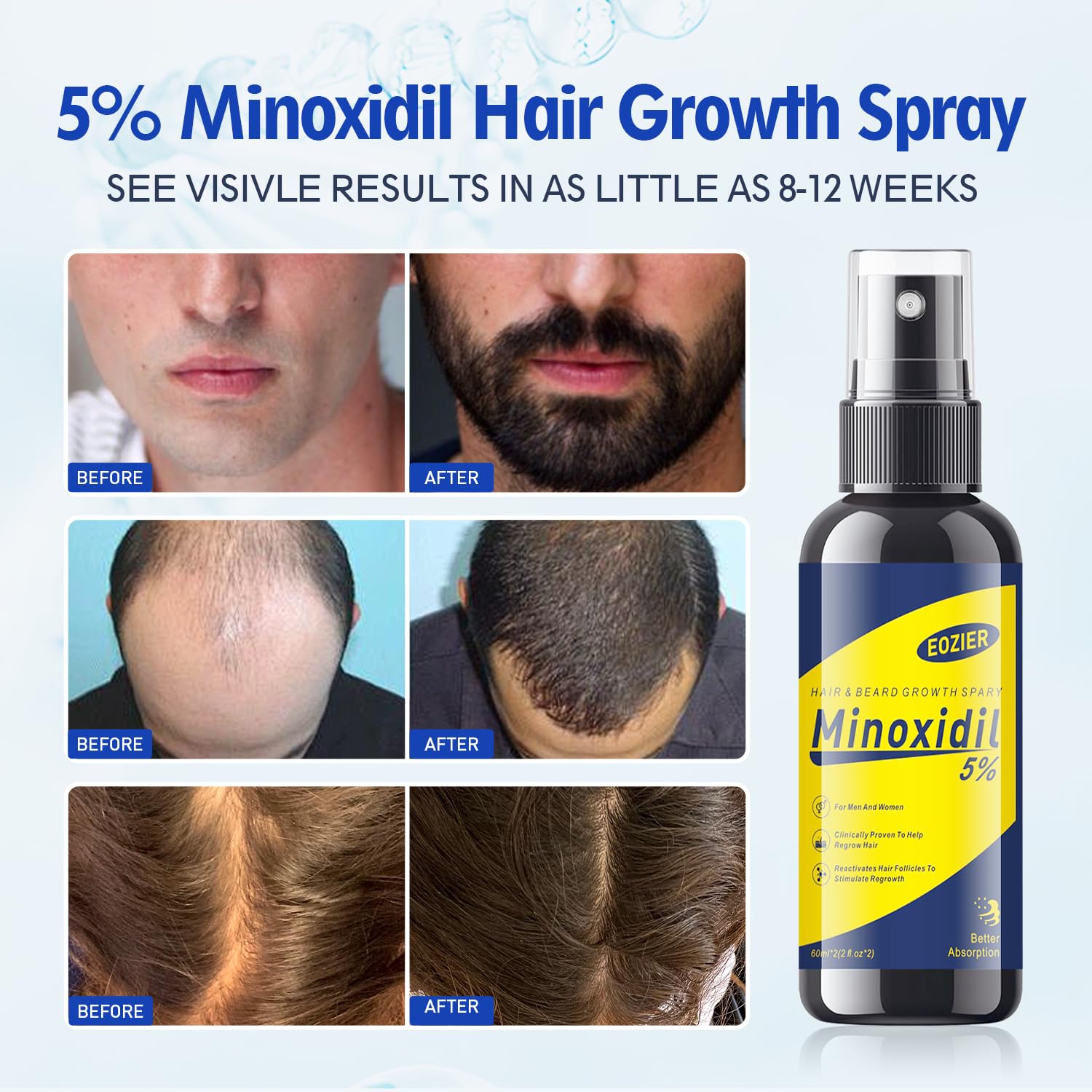 Collagène hydrolysé dans Eozier Minoxidil soutenant les cheveux