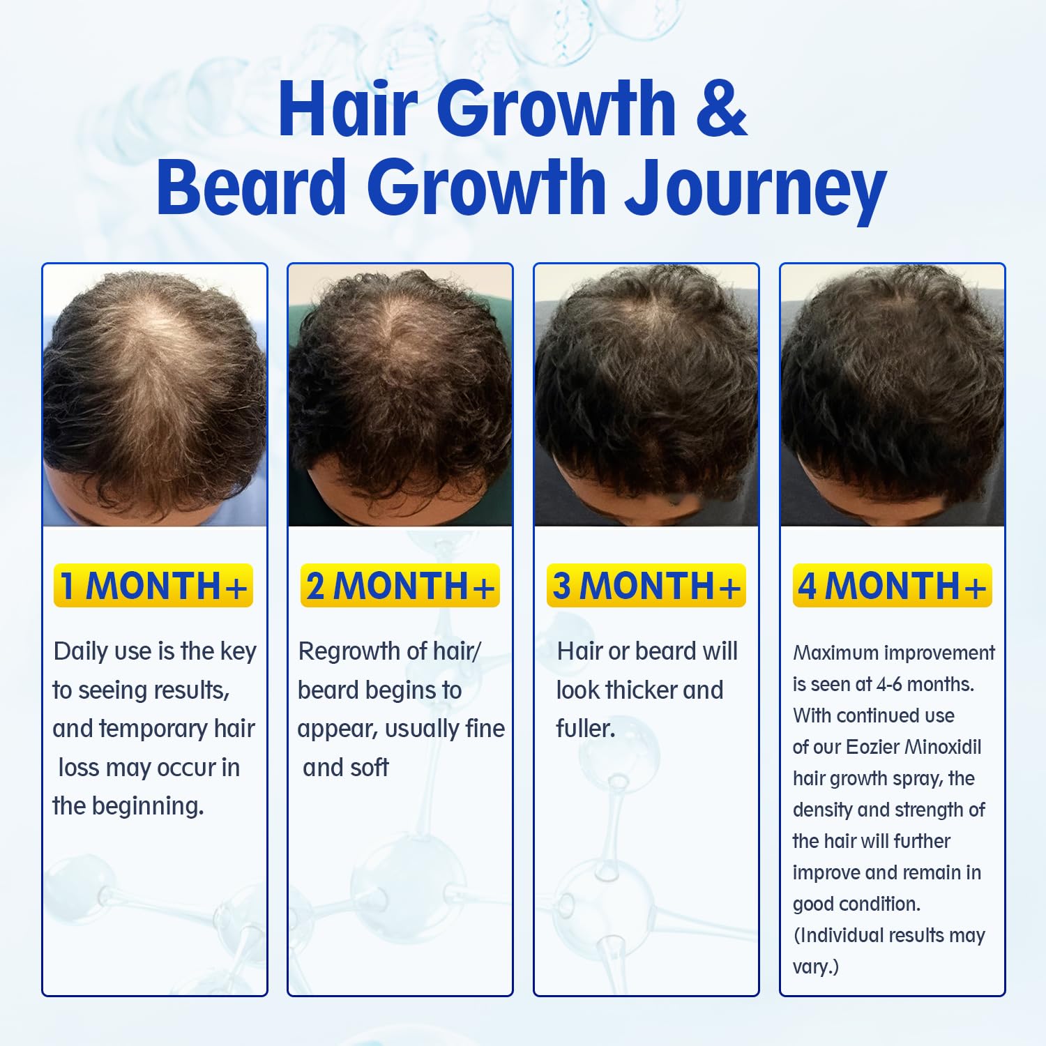 Duo pack Eozier Minoxidil pour usage continu sur cheveux et barbe