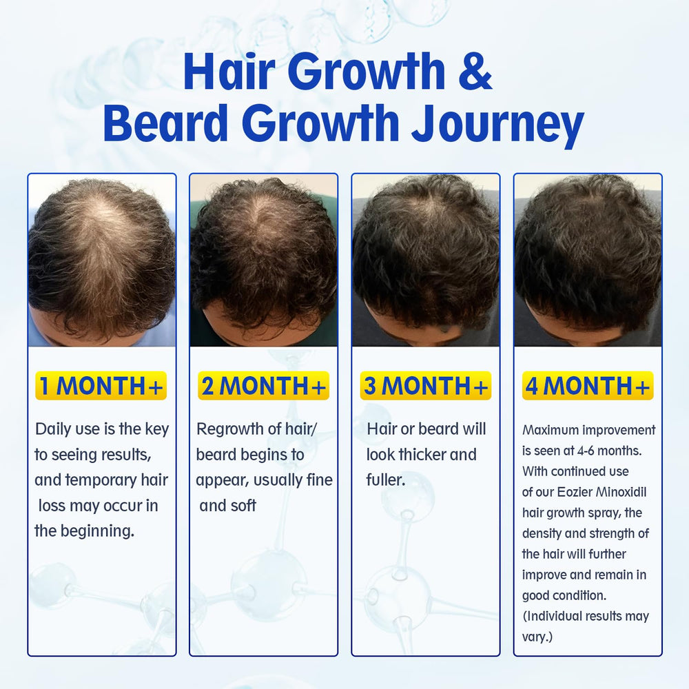 Duo pack Eozier Minoxidil pour usage continu sur cheveux et barbe