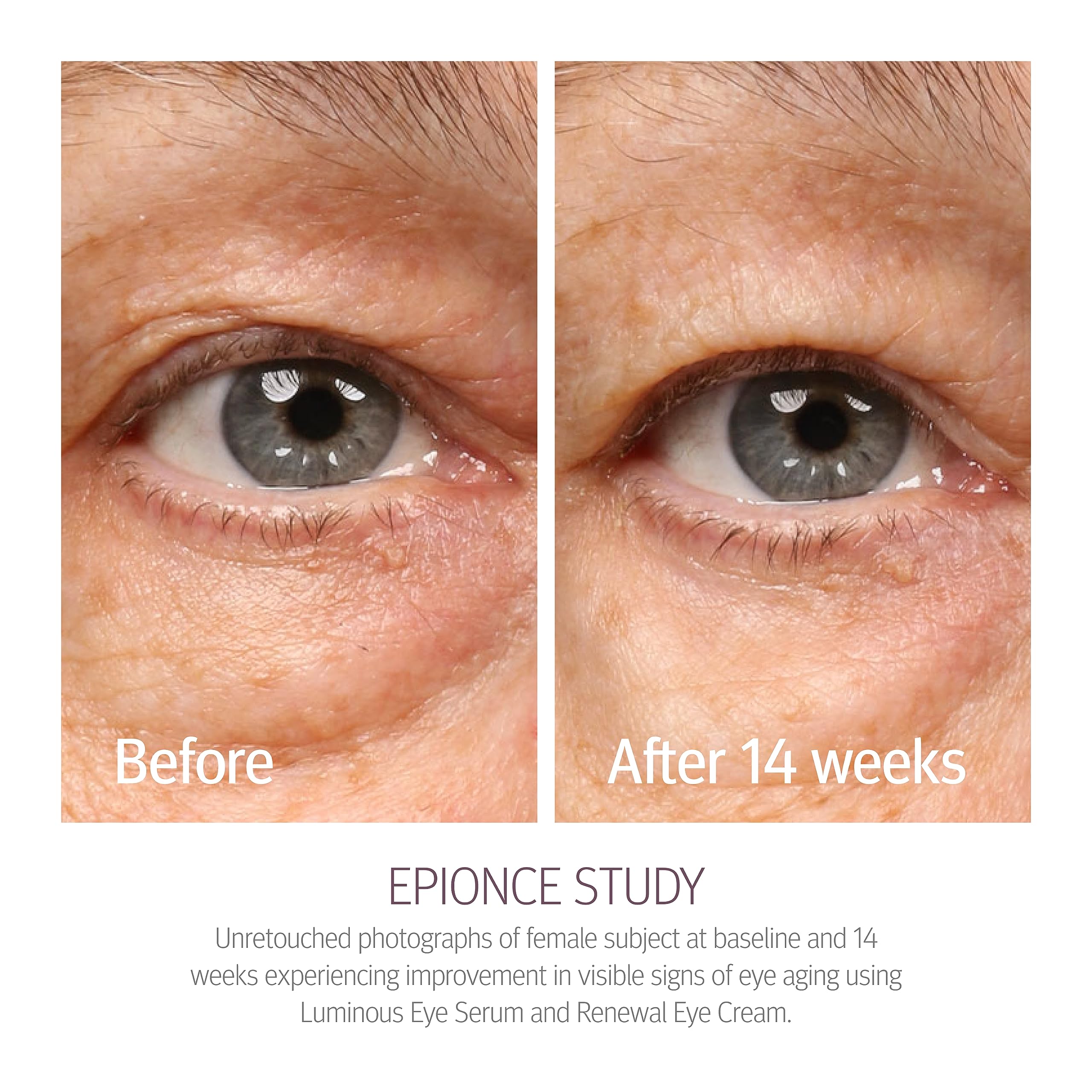 Emballage Renewal Eye Cream Epionce, soin quotidien du regard.