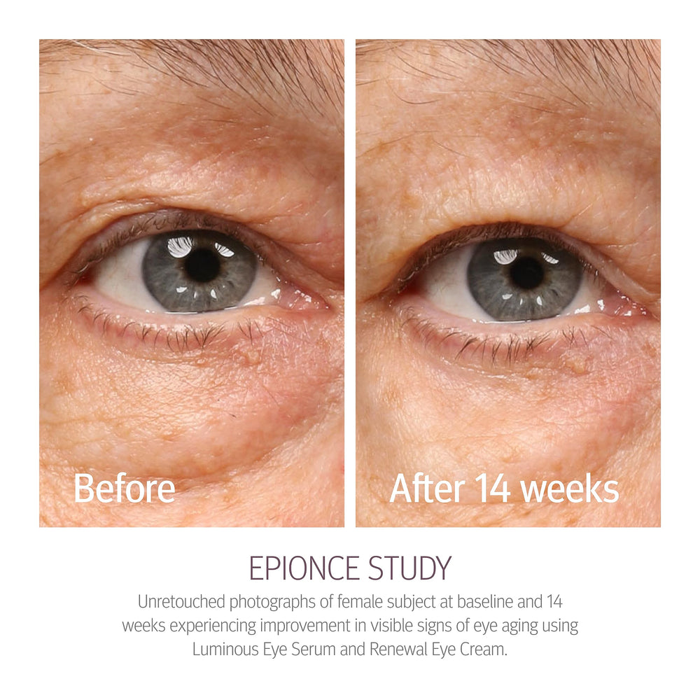 Emballage Renewal Eye Cream Epionce, soin quotidien du regard.
