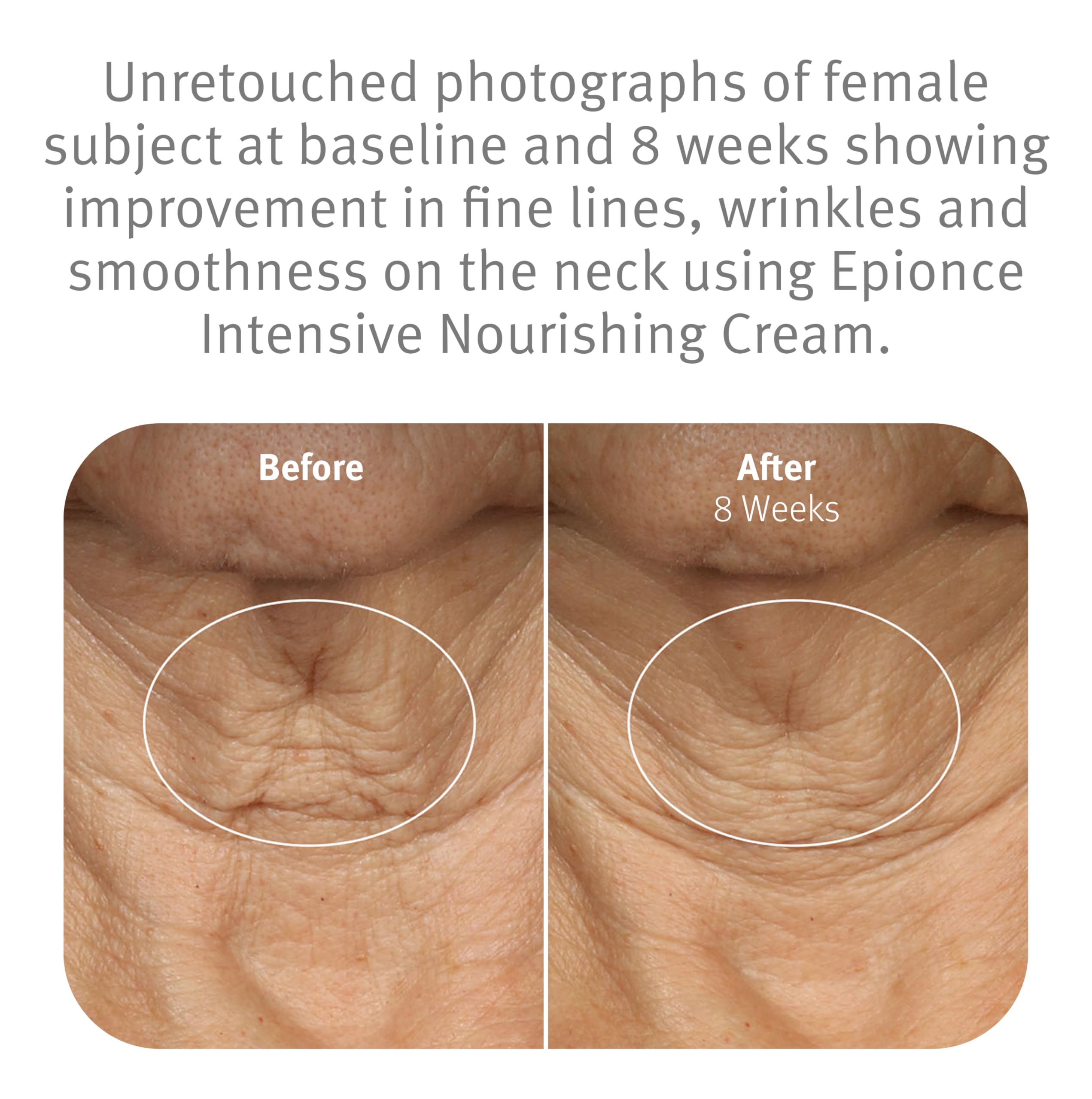 Epionce Intensive Nourishing Cream, ceramides incluses pour renforcer la barrière cutanée.