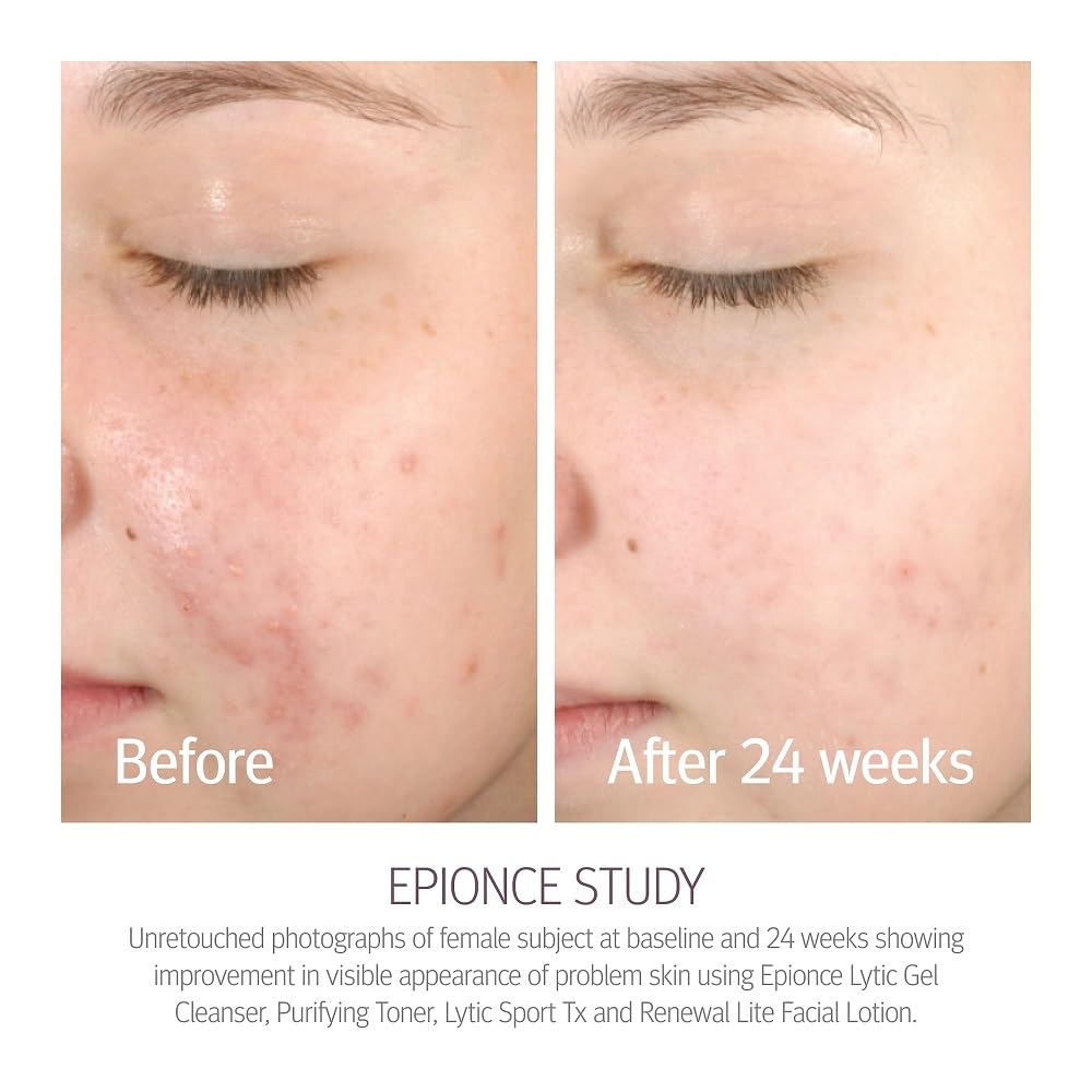 Epionce Renewal Lite Lotion : application matin, peau prête à la journée