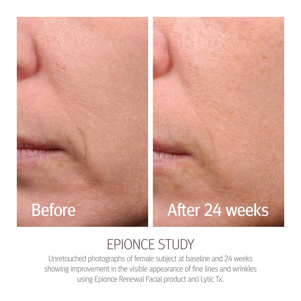 Application facile d'Epionce Renewal Facial Lotion dans la routine visage