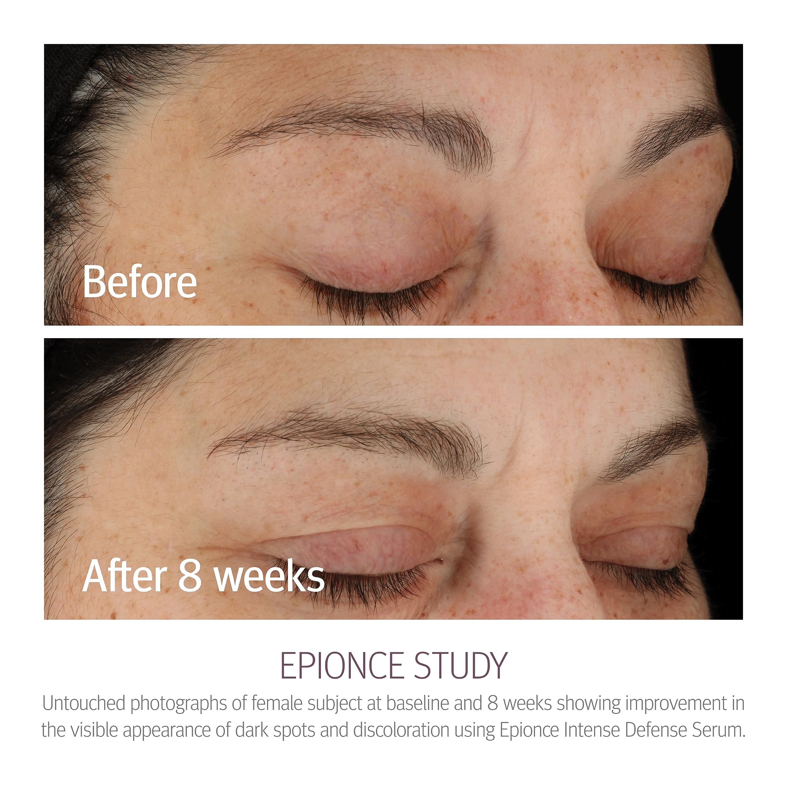 Étiquette Emballage Epionce Defense Intense, présentation professionnelle et soin dermatologique.