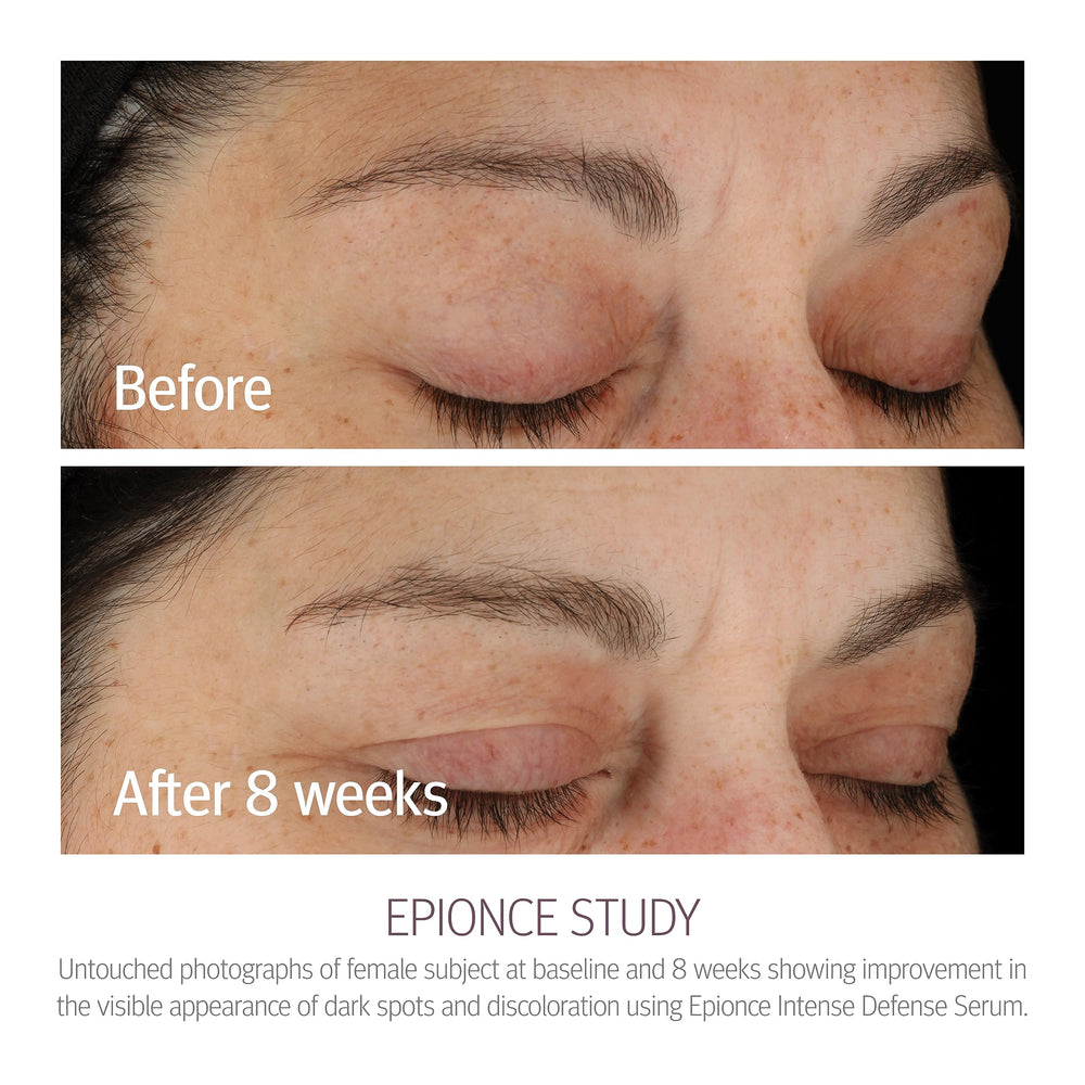 Étiquette Emballage Epionce Defense Intense, présentation professionnelle et soin dermatologique.