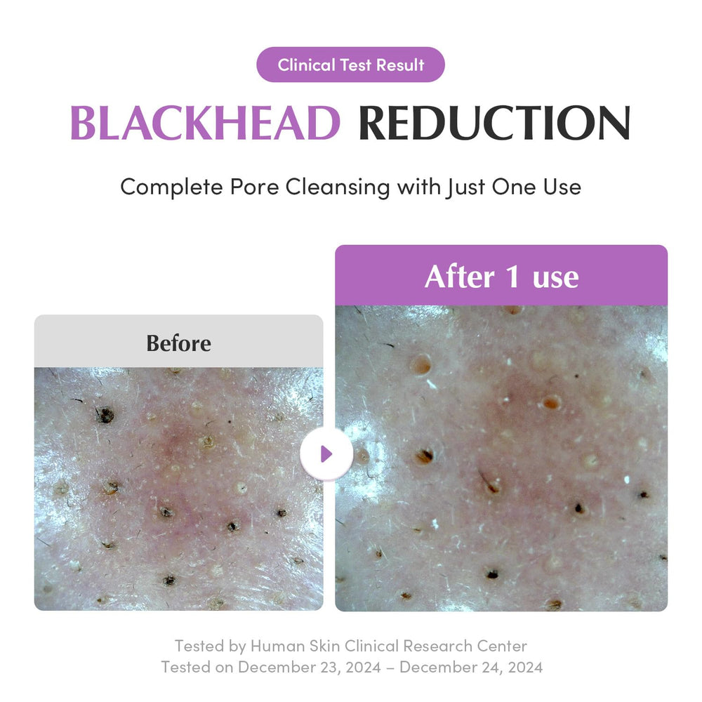EQQUALBERRY hydratation-hyaluronique-céramides assure douceur sans tiraillement.