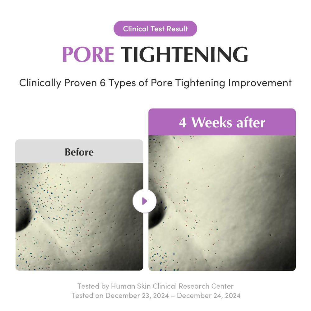Pores raffermis et peau plus lisse grâce au sérum ciblé.