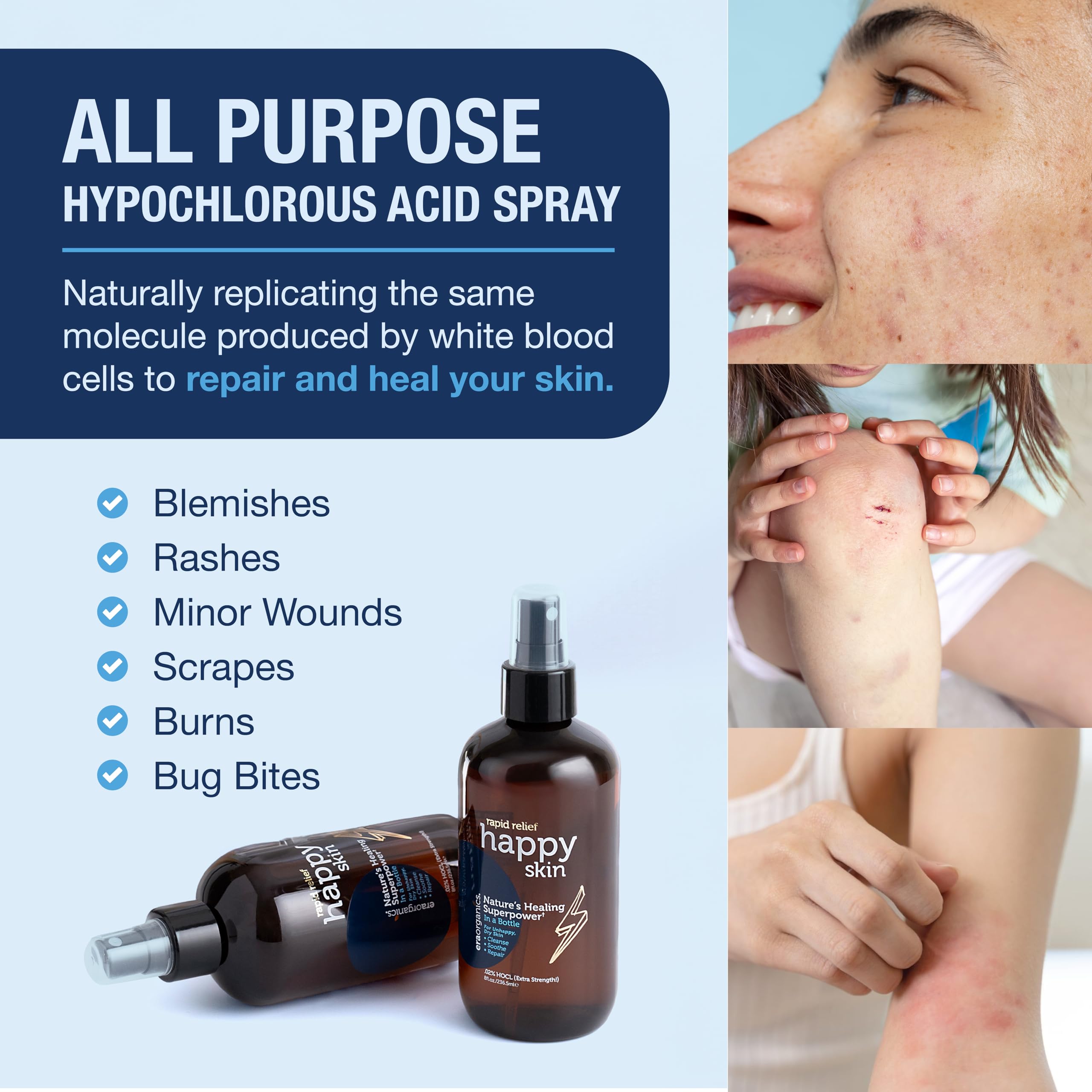 Era Organics Happy Skin HOCl spray on body to soothe skin