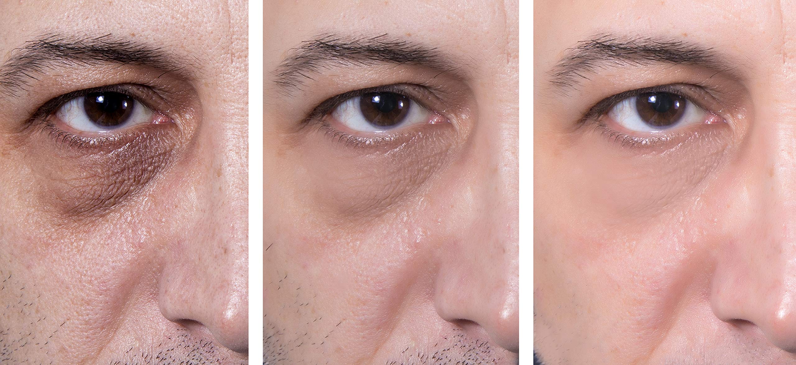 Gel yeux Essence d'Arcadia nourrit la peau délicate du contour