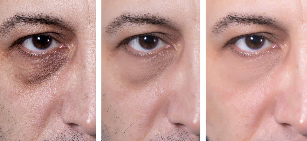 Gel yeux Essence d'Arcadia nourrit la peau délicate du contour