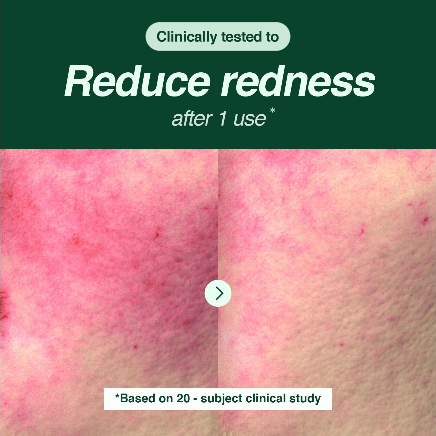 Application de la mousse ESSENHERB sur le visage quotidien.