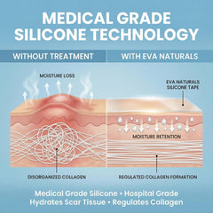 Bandes Eva Naturals en silicone pour cicatrice post-chirurgie, hydratation et confort.
