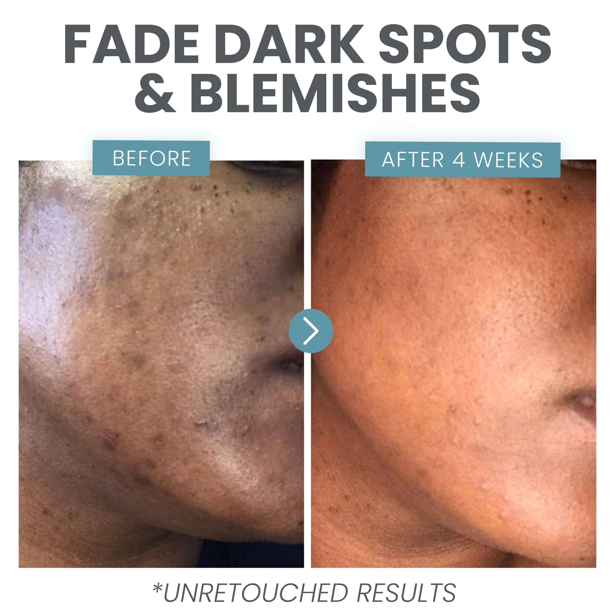 Équilibre de l’épiderme grâce à Niacinamide et MSM dans Eva Naturals.