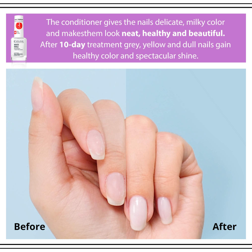 Élimination des décolorations avec Eveline 3 en 1 sur ongles
