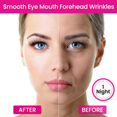 Évpct bandes visage rides bouche coin-sourire: patchs souples pour les ridules autour de la bouche.