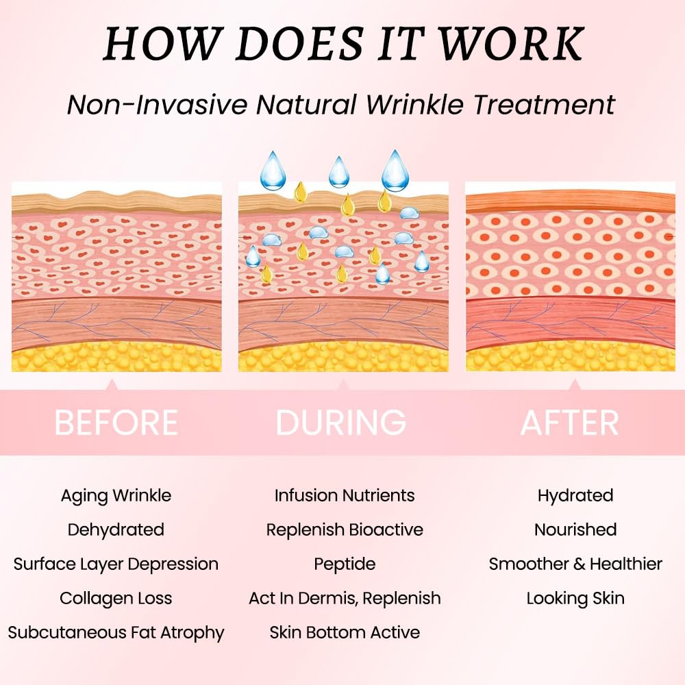 Évpct bandes visage utilisation nuit: patchs non irritants qui adhèrent en sommeil.