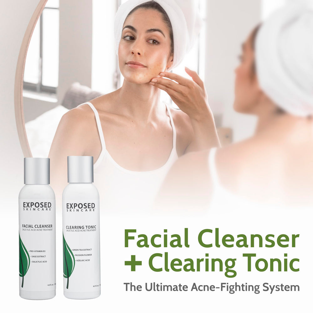 Boîte Exposed Skin Care – présentation soignée du kit anti-imperfections.