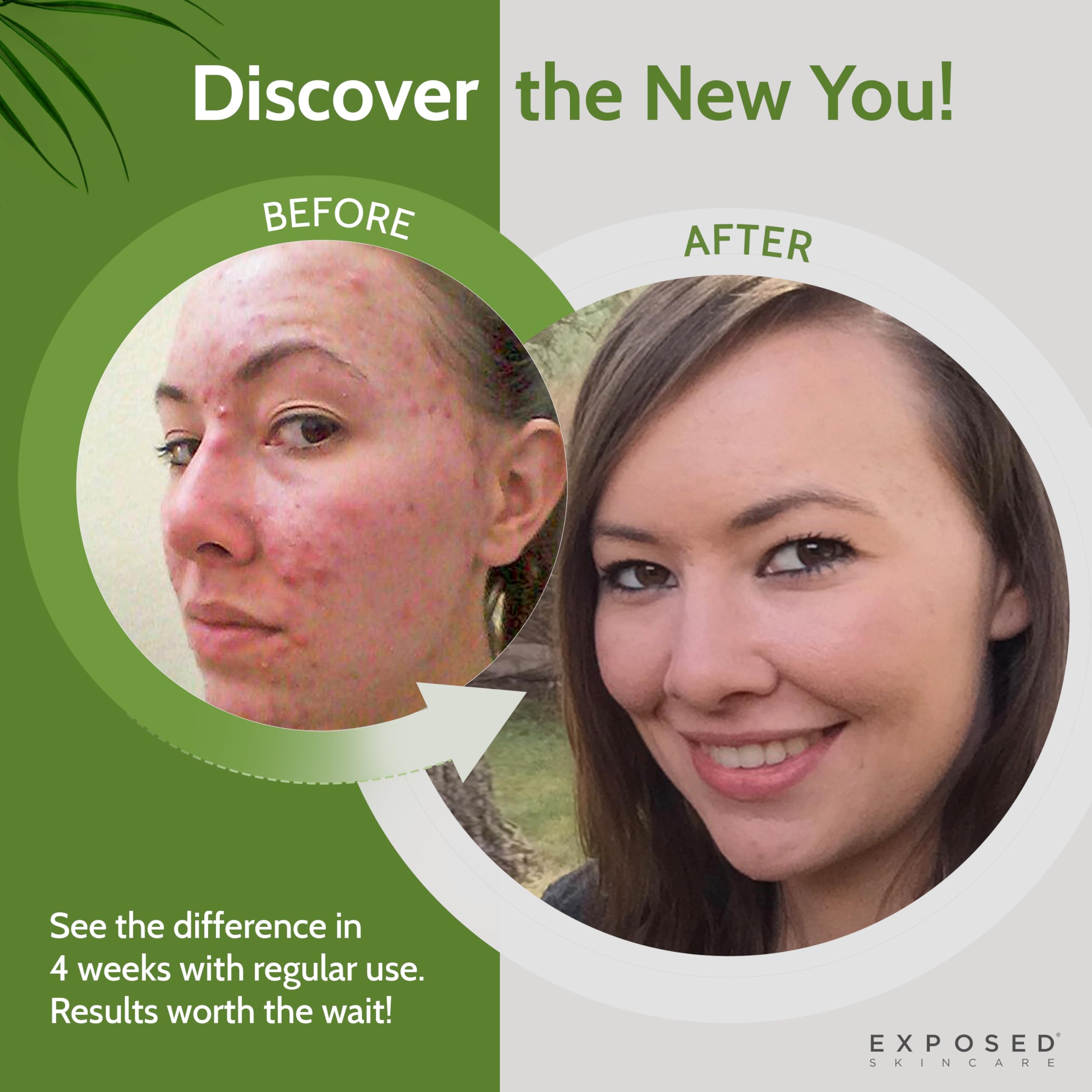 Exposed Skin Care tonique avec extrait thé vert pour anti-oxydants