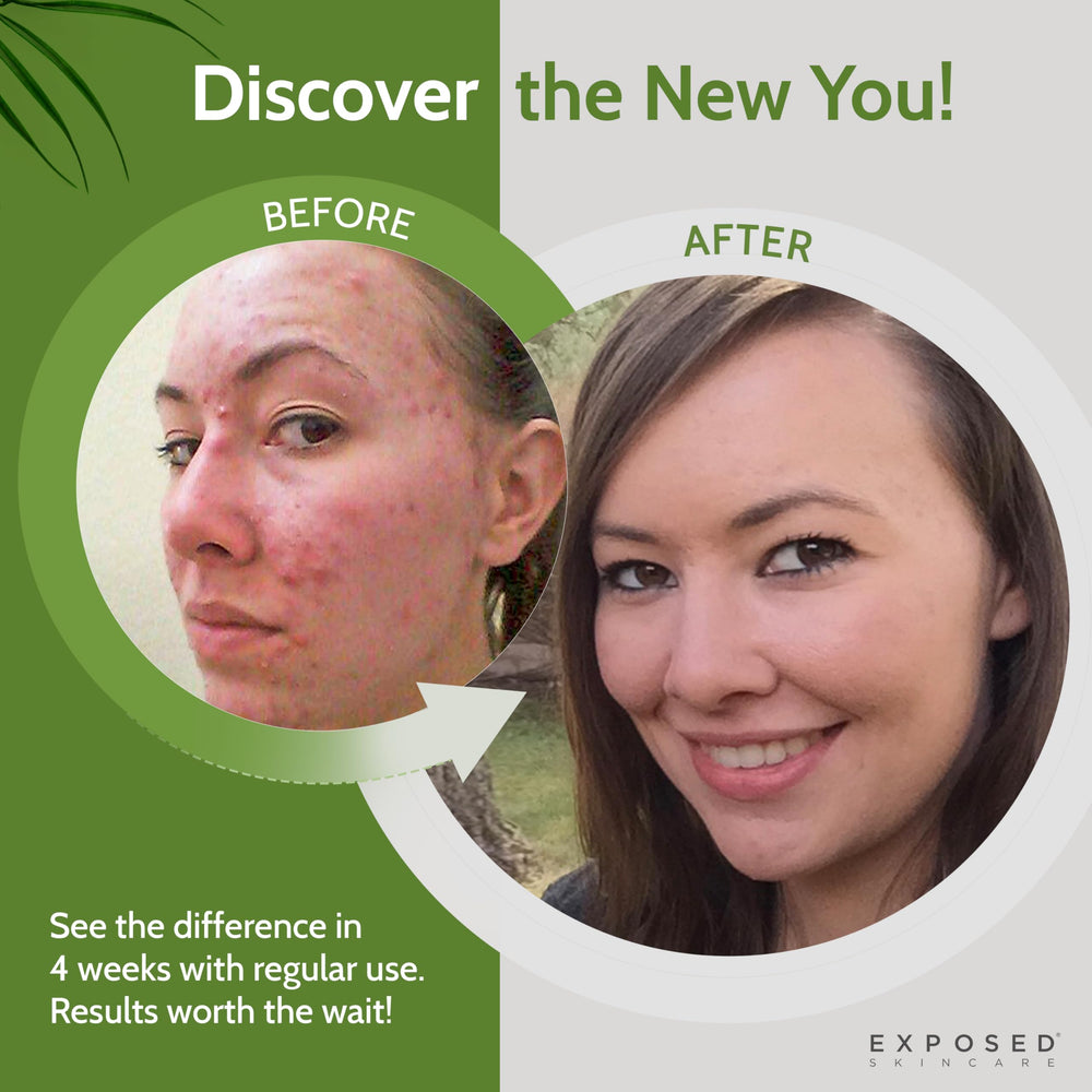 Exposed Skin Care tonique avec extrait thé vert pour anti-oxydants