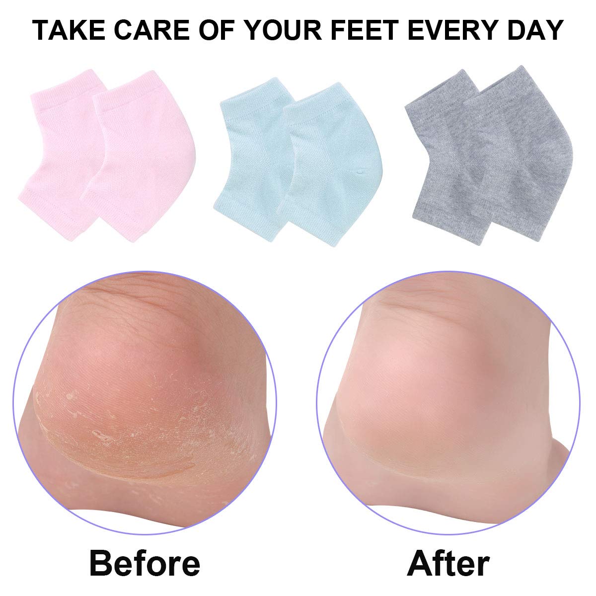 Exptolii chaussettes gel talons usage quotidien pour hydrater les pieds.