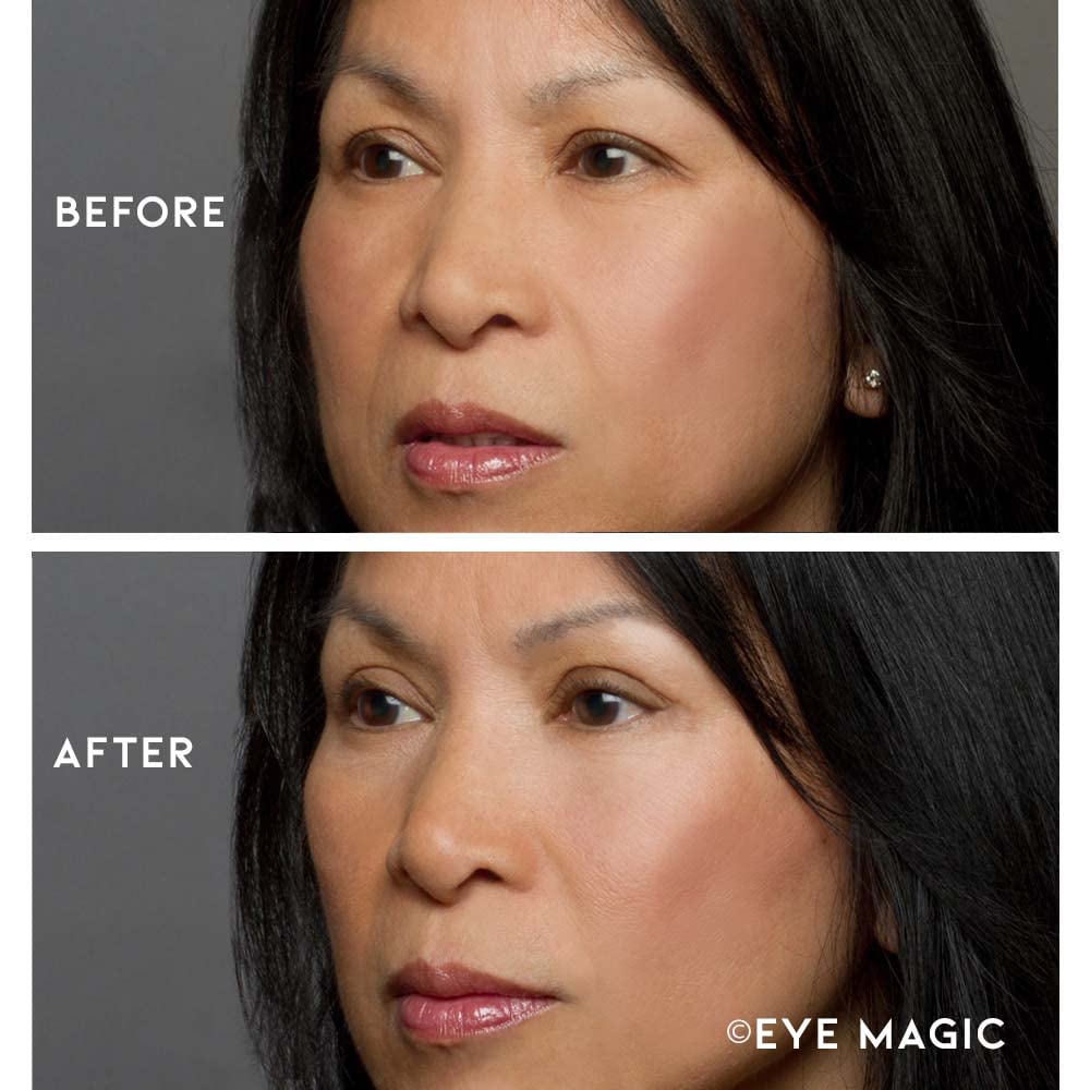 Adhésifs hypoallergéniques Eye Magic, adaptés peaux sensibles.