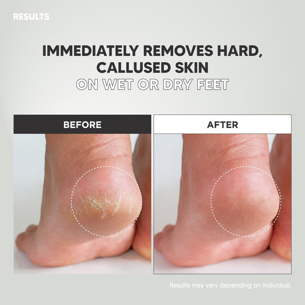 F3 Systems utilisation personnelle rose, soin des pieds quotidien.