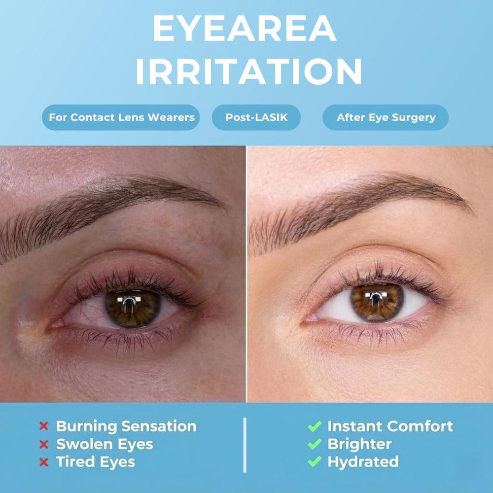 FACEMOON Masque yeux – 35 à 40 minutes de chaleur humide pour détendre les yeux