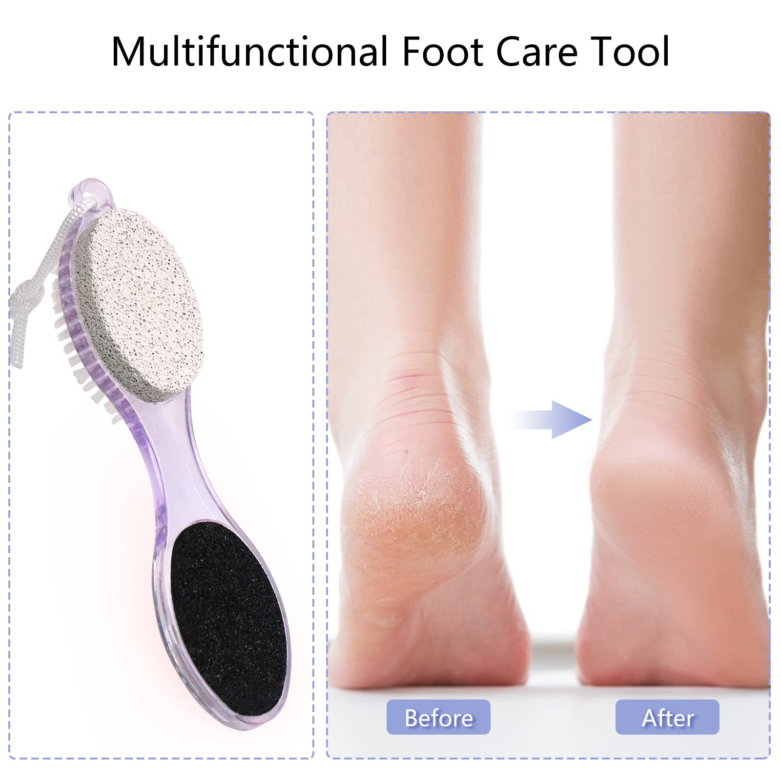 Kit pieds Fangze compact idéal pour le voyage.