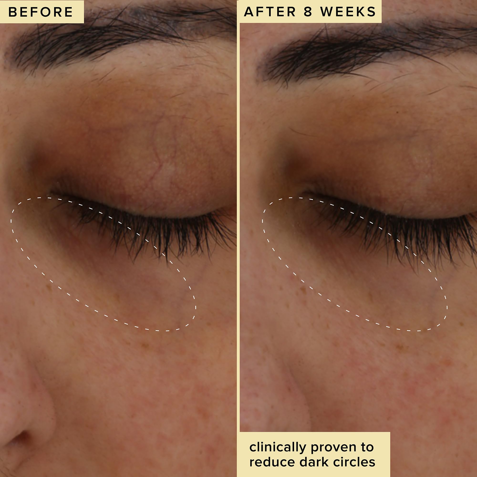 THD vitamine C, dérivé stabilisé, pour éclairer le contour des yeux Farmacy.
