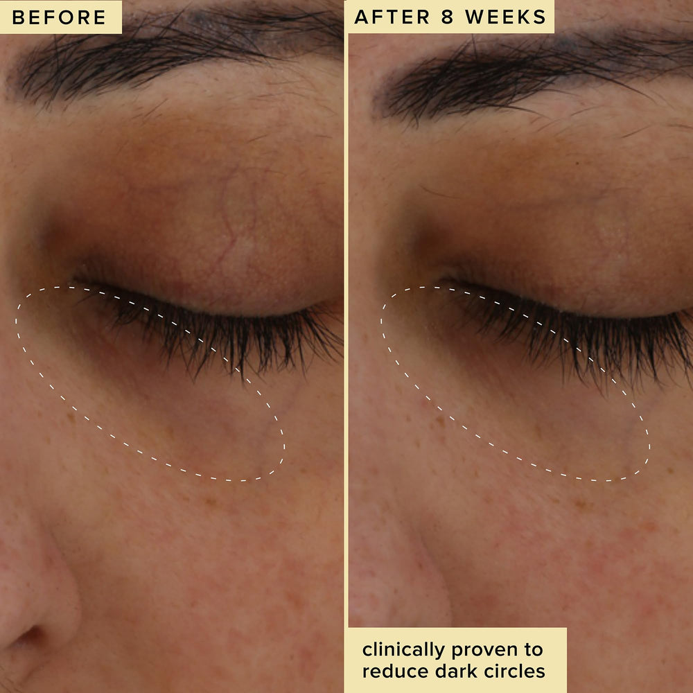THD vitamine C, dérivé stabilisé, pour éclairer le contour des yeux Farmacy.