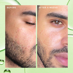 Farmacy Deep Sweep tonique visage - pores affinés et teint plus net.