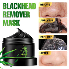 FeiCuiYun Charbon Noir Masque Visage: application à décollement facile et extraction en douceur.