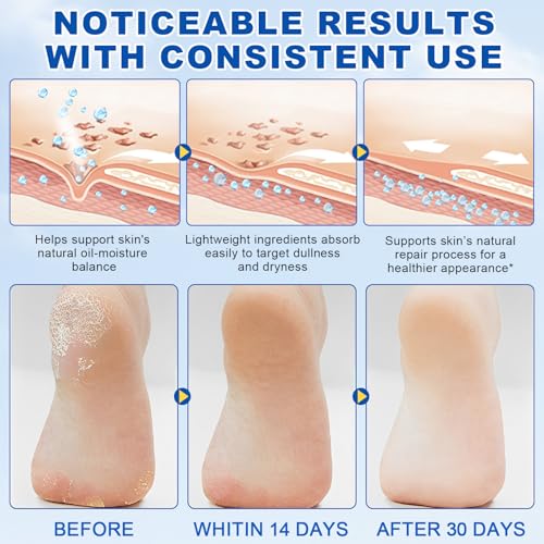 FEISIDUNWSF Crème Pieds 60% Urée, texture non gras qui adoucit callosités