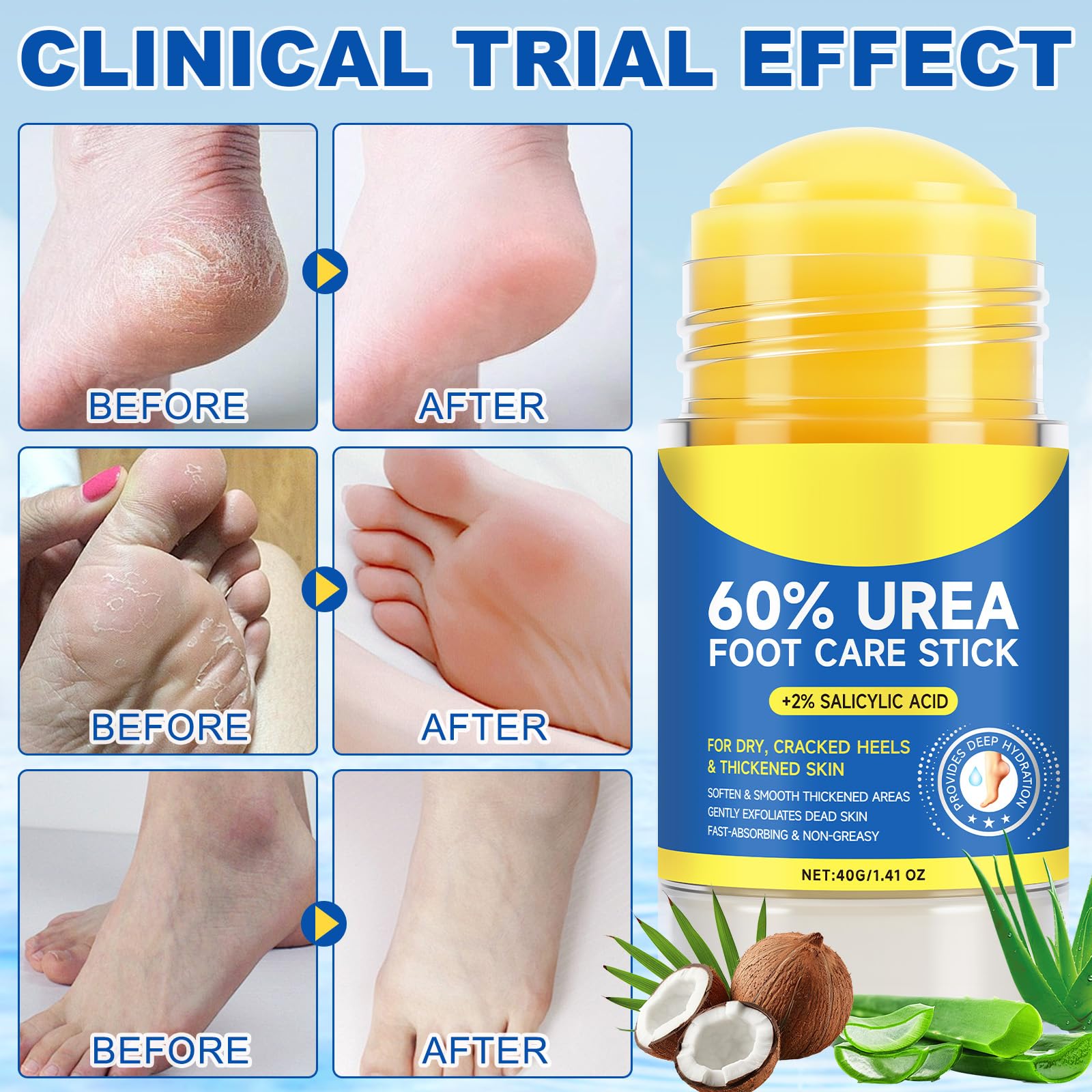 FEISIDUNWSF Crème Pieds 60% Urée, absorption rapide et non gras en un geste