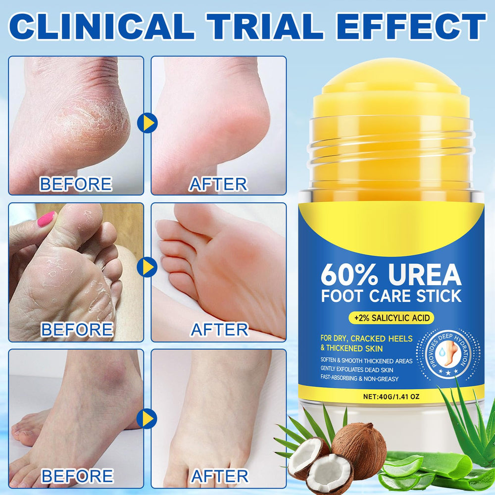 FEISIDUNWSF Crème Pieds 60% Urée, absorption rapide et non gras en un geste