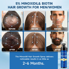 Felicemy Minoxidil bouteille pompe 5% pour cheveux.