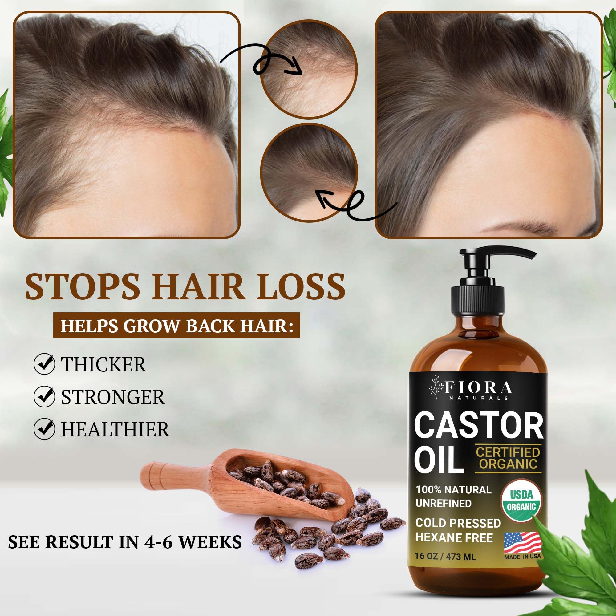 Soin capillaire Fiora Naturals: huile de ricin pour cheveux et ongles nourrissants.