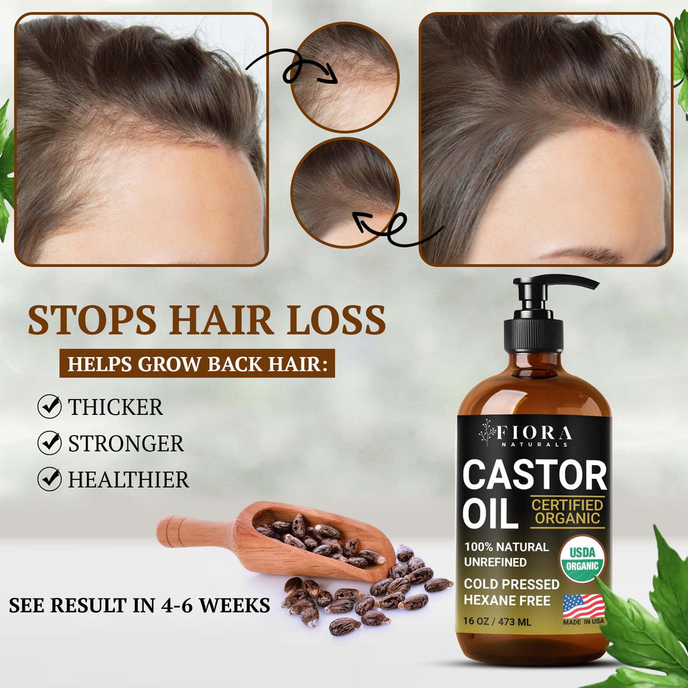 Soin capillaire Fiora Naturals: huile de ricin pour cheveux et ongles nourrissants.