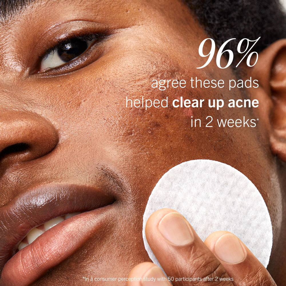 First Aid Beauty Acne Pads visage, texture douce respectant la barrière cutanée.