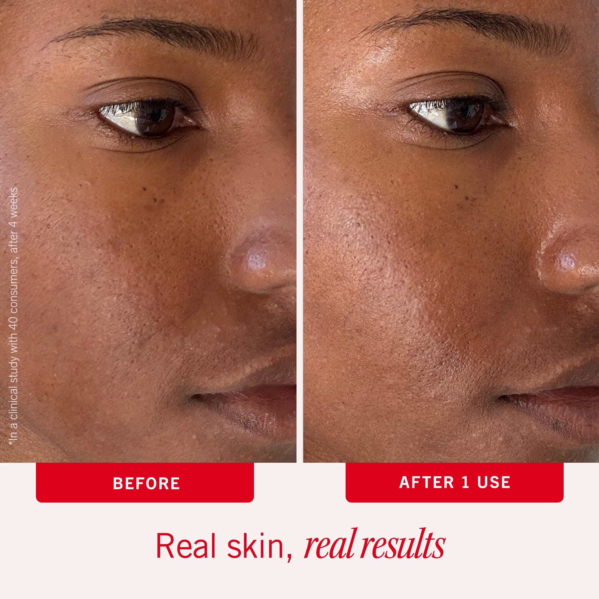 First Aid Beauty céramides renforcent la barrière cutanée lors du soin.
