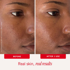 First Aid Beauty céramides renforcent la barrière cutanée lors du soin.