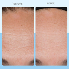 Application jour de la crème collagène First Aid Beauty sur le visage